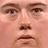 VTCO